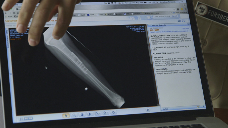 Computer screen showing a bone 