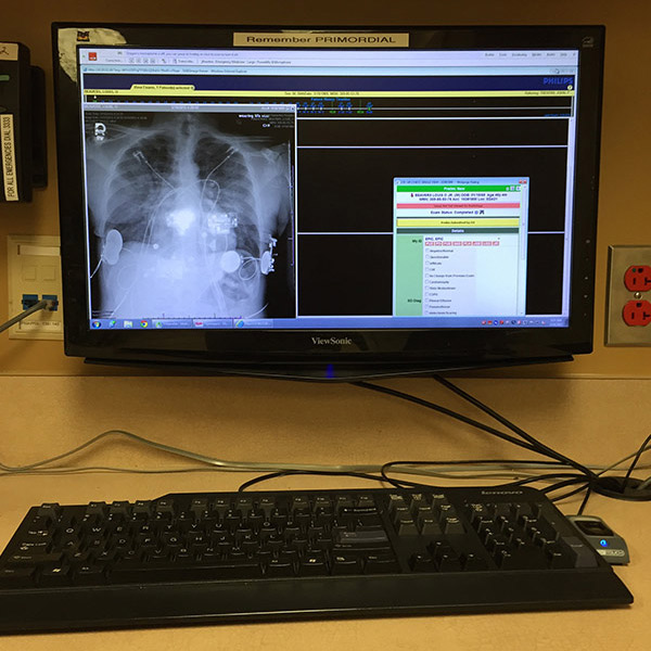 Workstation computer screen with xray 