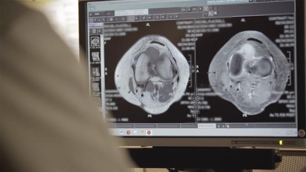 Computer screen showing bone scans  